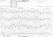 fig.3 カテコラミン感受性心室頻拍(トリプルマスター )時の心電図