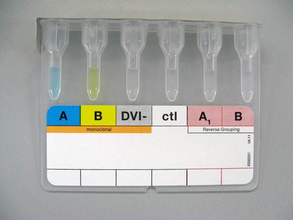 血液型検査カラム法